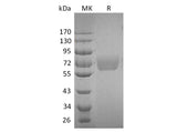 Recombinant Human IL4RA/CD124 Protein (Fc Tag)(Active)