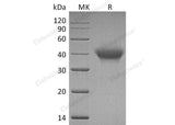 Recombinant Human IL5RA/IL-5 Rα Protein (His Tag)