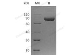 Recombinant Human IL5RA/IL-5 Rα Protein (Fc Tag) 