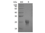 Recombinant Human Interleukin-5/IL-5 Protein (His Tag)(Active)