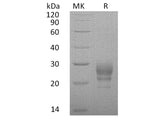 Recombinant Human Interleukin-7/IL-7 Protein (His Tag)(Active)