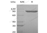 Recombinant Human ITIH3 Protein (His Tag)