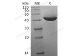 Recombinant Human IDH1 Protein (His Tag)