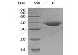 Recombinant Human JAM-B/CD322 Protein (His Tag)