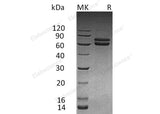 Recombinant Human JAM-B/CD322 Protein (Fc Tag)