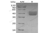 Recombinant Human Kallikrein 1/KLK1 Protein (His Tag)