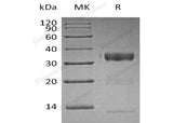 Recombinant Human Kallikrein 10/KLK10 Protein (His Tag)