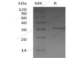 Recombinant Human Kallikrein 2/KLK2 Protein (His Tag) 