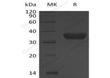 Recombinant Human KLK-8/Kallikrein-8 Protein (His Tag)