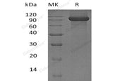 Recombinant Human KEL/CD238 Protein (His Tag)