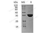 Recombinant Human Ketohexokinase/KHK Protein (His Tag)