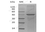 Recombinant Human Arginase-2/ARG2 Protein (His Tag)