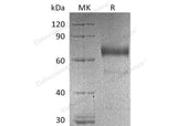 Recombinant Human KIR2DL3/NKAT2 Protein (Fc Tag) 