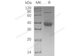 Recombinant Human KIR2DL4/CD158D Protein (His Tag)