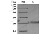 Recombinant Human Lacritin/LACRT Protein (His Tag)