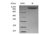 Recombinant Human LAMP1/CD107a Protein (Fc Tag)(Active)