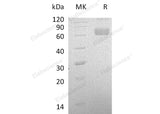 Recombinant Human LCAT Protein (His Tag)