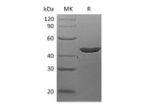 Recombinant Human LEFTY2 Protein (His Tag)