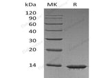 Recombinant Human Leptin Protein