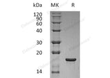 Recombinant Human LIF Protein (E.coli)(Active)