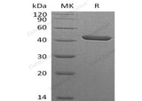 Recombinant Human SERPINB1/PI2 Protein (Human Cells, His Tag)