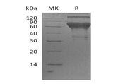 Recombinant Human LMIR2/CD300C Protein (Fc Tag)