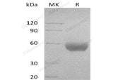 Recombinant Human CD47/IAP Protein (Fc Tag)(Active)