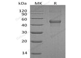 Recombinant Human LMCD1/Dyxin Protein (His Tag)