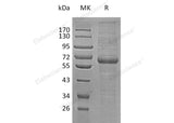 Recombinant Human LRP12 Protein (His Tag)