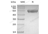 Recombinant Human Lumican/LUM Protein (His Tag)