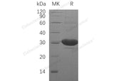 Recombinant Human DCXR Protein (His Tag)