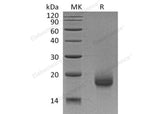 Recombinant Human LY6H Protein (His Tag)