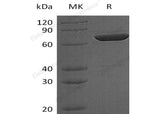 Recombinant Human LCP2 Protein (His Tag, N-T7 Tag)