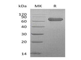 Recombinant Human LTBR/TNFRSF3 Protein (Fc Tag)