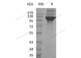 Recombinant Human KARS Protein (His Tag)