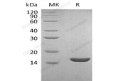 Recombinant Human Lysozyme C/LYZ Protein (His Tag)