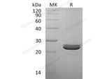 Recombinant Human LYG2 Protein (His Tag)