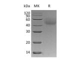 Recombinant Human LYVE1/HAR Protein (His Tag)