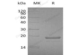 Recombinant Human MDP1 Protein (His Tag) 