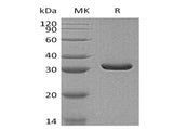 Recombinant Human MDH2 Protein (His Tag)