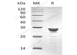 Recombinant Human MAA/GSTZ1 Protein (His Tag)