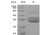 Recombinant Human EPDR1 Protein (His Tag)