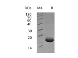 Recombinant Human MANF/ARMET Protein (His Tag)