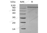 Recombinant Human MASP1 Protein (His Tag)