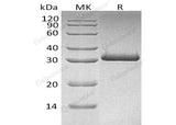 Recombinant Human MBL2/MBL/COLEC1 Protein (His Tag)