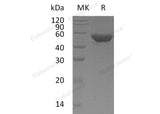 Recombinant Human MGAT2/GlcNAc-TII Protein (His Tag)