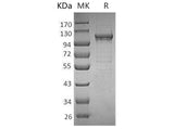 Recombinant Human MANSC1 Protein (His Tag)