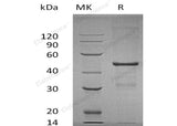 Recombinant Human MBIP Protein (His Tag)