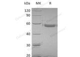 Recombinant Human MMP1 Protein (His Tag)