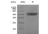 Recombinant Human M-CSF/CSF1 Protein (His Tag)(Active)